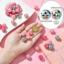 50Pcs UV Plating Opeque Acrylic Beads&nbsp;MACR-CJ0001-99